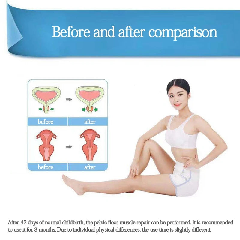 Spare Vaginal Incontinence Probe - Electrodes for Pelvic Floor Exerciser - For Use With EMS Machines